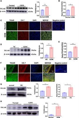 TIGAR deficiency induces caspase-1-dependent trophoblasts pyroptosis through NLRP3-ASC inflammasome
